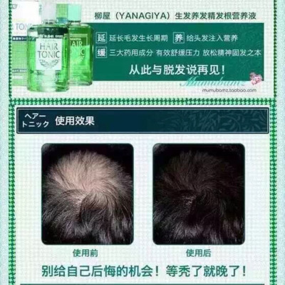 產后脫發怎么辦？這些方法幫你減少掉發，拒絕禿頂危機